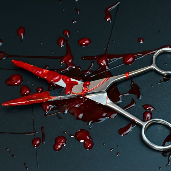 Frauenarzt wegen Genitalverstümmelung von Ehefrau angeklagt