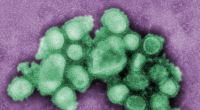 In Großbritannien hat sich eine Person mit der Schweinegrippe-Variante H1N2 infiziert. (Symbolfoto)