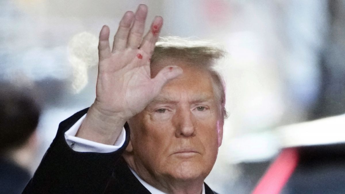 Die mysteriösen Flecken an Donalds Trump Hand sollen nicht auf eine Krankheit zurückzuführen sein. (Foto)