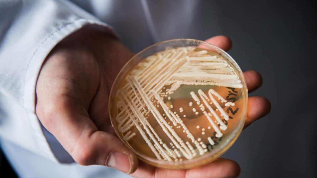 Der Leiter des Nationalen Referenzzentrums für invasive Pilzinfektionen, Oliver Kurzai, hält eine Petrischale mit dem Hefepilz Candida auris in den Händen. (Foto)