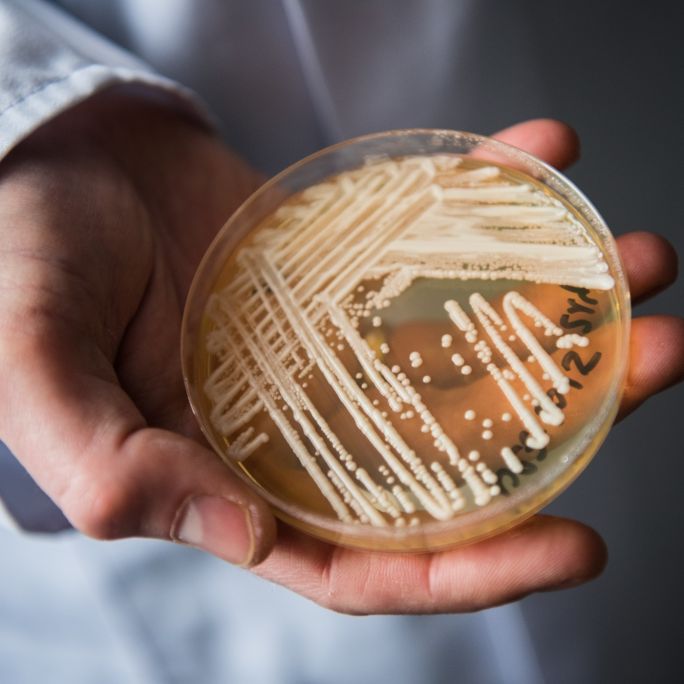 Der Leiter des Nationalen Referenzzentrums für invasive Pilzinfektionen, Oliver Kurzai, hält eine Petrischale mit dem Hefepilz Candida auris in den Händen.
