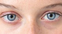 Eine Infektion mit den neuartigen Coronaviren kann den Augen schaden (Symbolfoto).