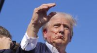 Donald Trump wurde bei dem Attentat am Ohr verletzt.