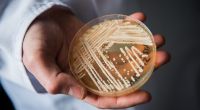 Auch in Deutschland werden immer mehr Fälle bekannt, in denen schwer kranke Patienten mit dem gefährlichen Hefepilz Candida auris infiziert sind.