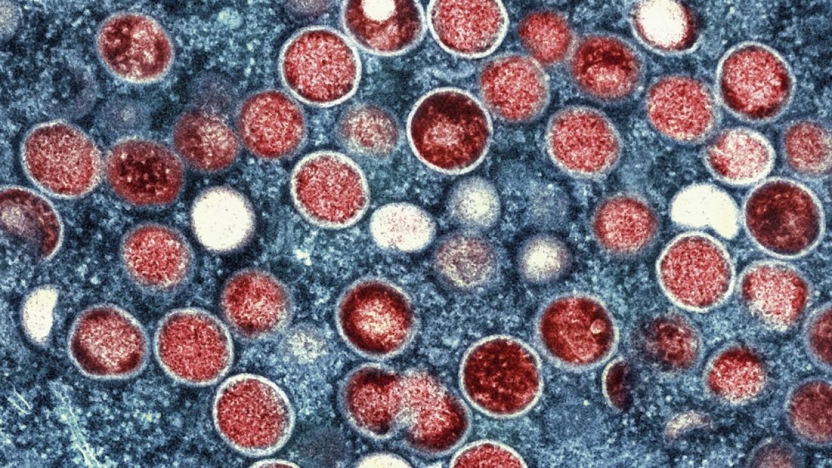 Eine eingef&auml;rbte Mikroskopaufnahme von Mpox-Partikeln (rot) in einer infizierten Zelle (blau), die im Labor kultiviert wurde. (Foto)