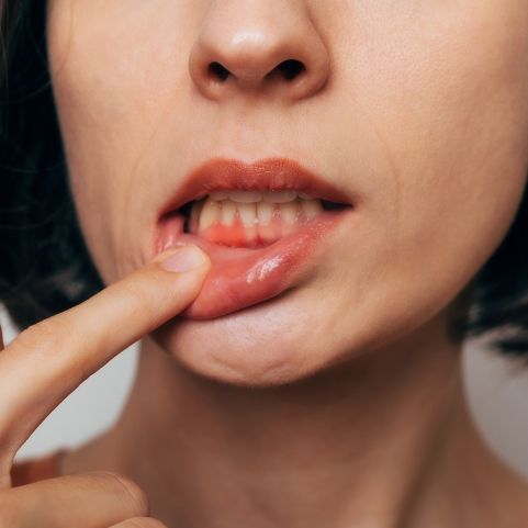 Das verrät die Farbe Ihres Zahnfleisches über Ihre Gesundheit
