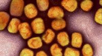 Affenpocken oder auch Mpox, ist eine virale Infektionskrankheit, die durch das Mpox-Virus verursacht wird. Es gehört zur Familie der Pockenviren (Orthopoxviridae).