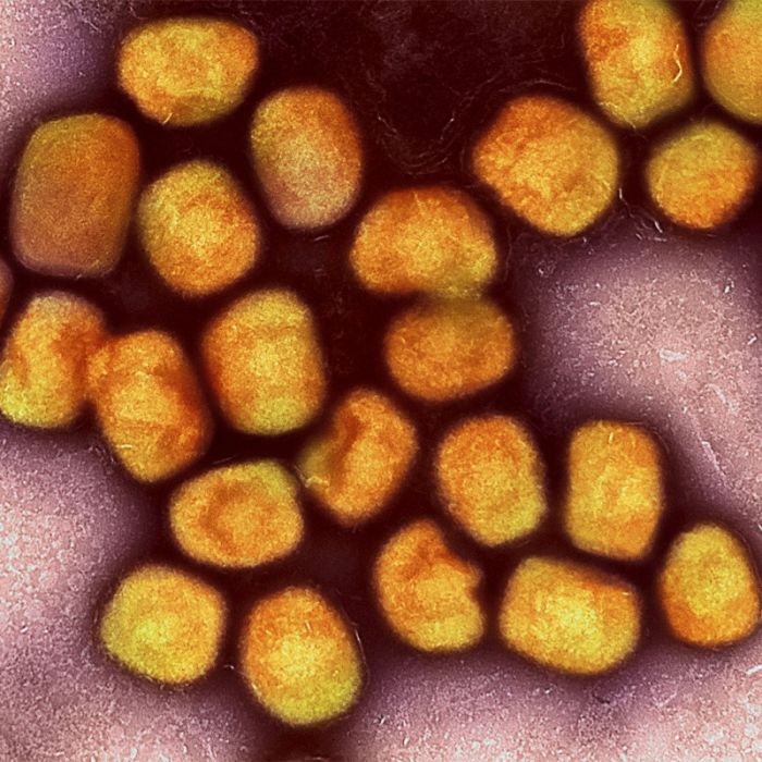Erster Mpox-Fall in Deutschland - Auf welche Symptome Sie achten sollten