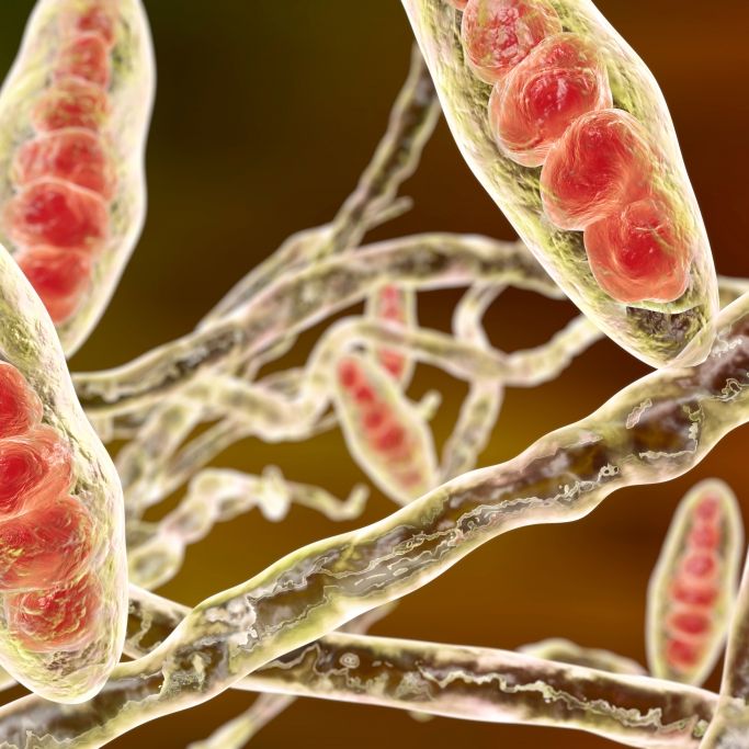 Experten warnen vor Ausbreitung von 