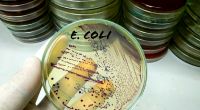 Eine neue e.coli-Variante besorgt schwedische Experten. (Symbolfoto)