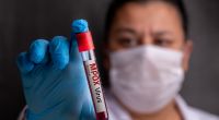 Die gefährliche Mpox-Variante Klade 1b breitet sich in Europa aus.