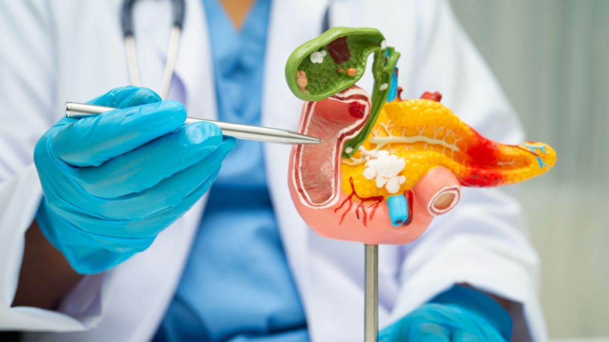 In der Bauchspeicheldrüse kann sich ein besonders perfider Krebs einnisten. (Foto)