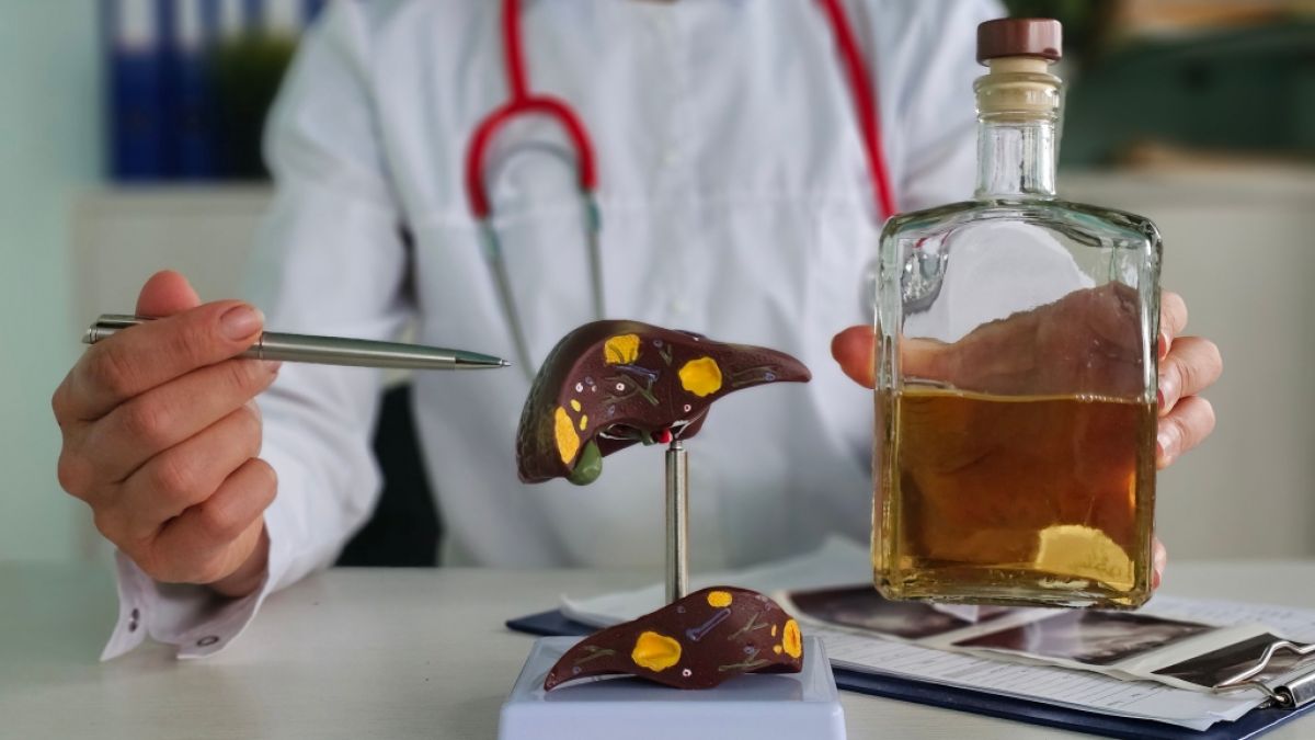 Bestimmte Dinge wie Alkohol und Übergewicht können zu einer Fettleber-Erkrankung führen. (Foto)