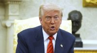 Donald Trumps Hautton ist durchaus ungewöhnlich.