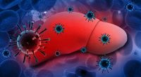 Eine Hepatitis-Infektion kann die Leber angreifen.
