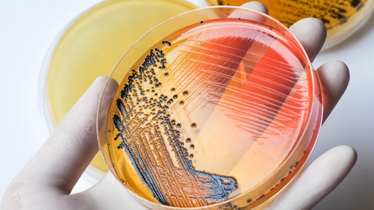 Wer sich mit Salmonellen infiziert, erlebt nicht selten Magen-Darm-Symptome von Übelkeit und Erbrechen über Durchfall bis hin zu Fieber, Kopf- und Muskelschmerzen und Bauchweh. (Foto)