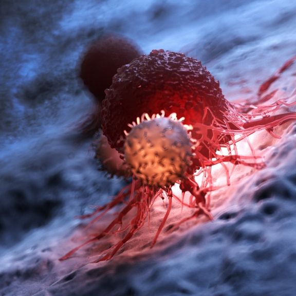 Rat vom Onkologen - mit diesen Fragen können Sie Ihr Krebsrisiko einschätzen