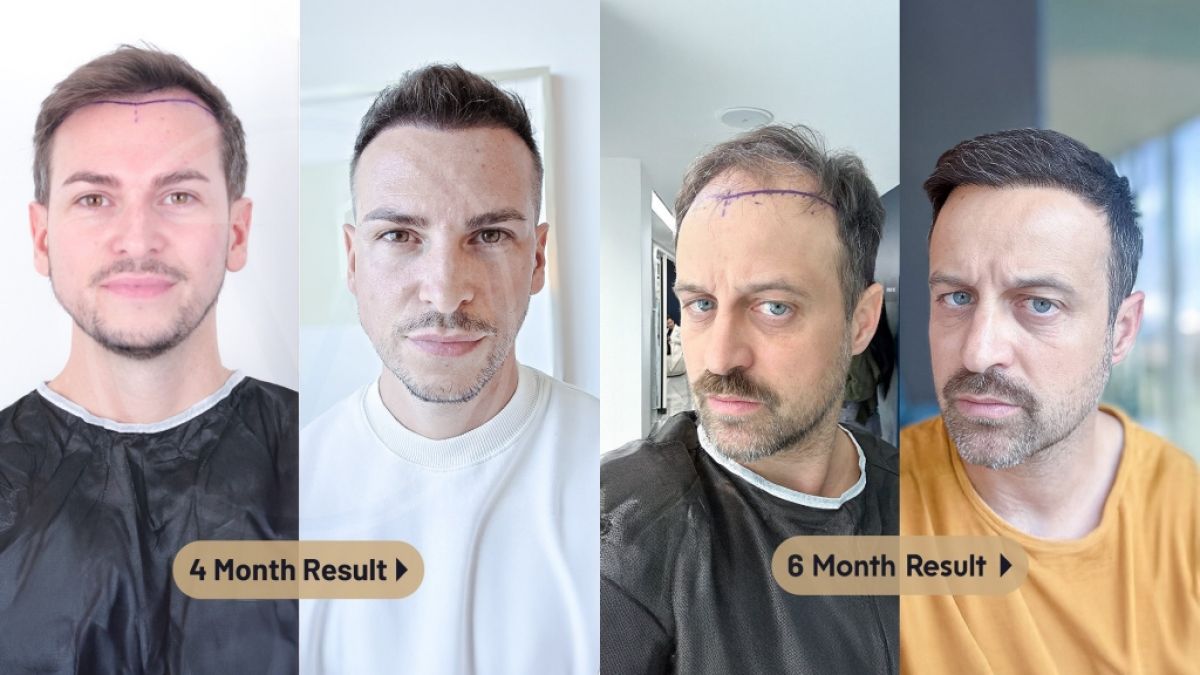 Auf Basis der Analyse wird eine grafische Karte des Empfängerbereichs erstellt. (Foto)