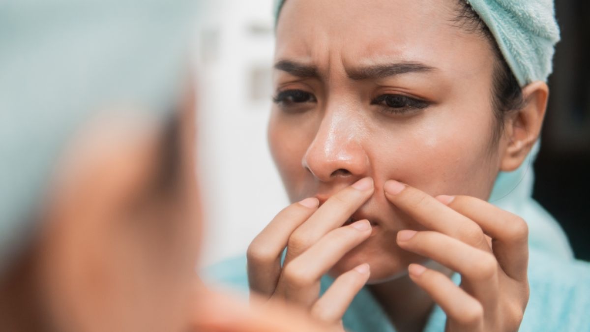 Wer an dieser Stelle einen Pickel ausdr&uuml;ckt, muss mit fiesen Infektionen rechnen. (Foto)