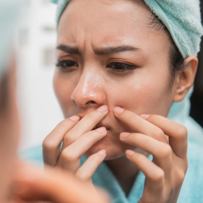 Infektion nach Ausdrücken von Pickeln kann tödlich enden