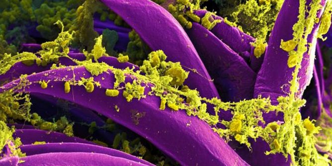 Pest-Infektion in Kalifornien
