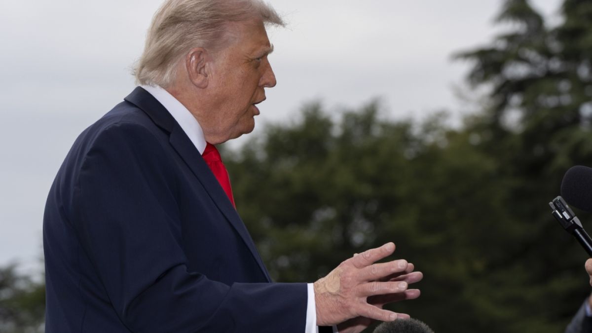 Um seine Blutergüsse an den Händen zu kaschieren, nutzt Donald Trump immer wieder Make-up - nur leider nicht im passenden Farbton, was die Blessur noch mehr ins Auge springen lässt. (Foto)