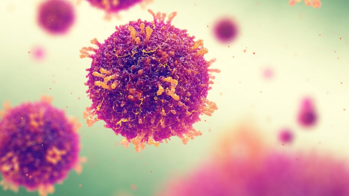 Masern breiten sich weltweit aus. (Foto)