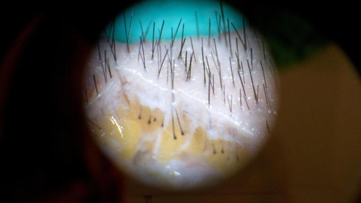 Foto: Andrea Warnecke, dpa (Foto)