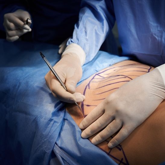 Influencerin nach Beauty-OP gestorben - jetzt ermittelt die Polizei