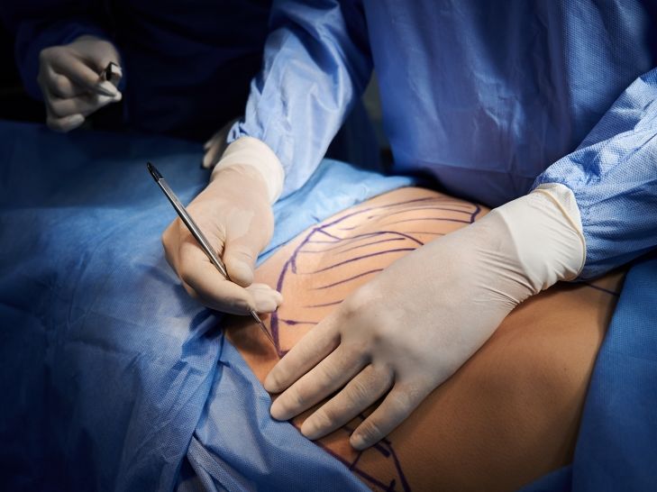 Yulia Burtseva ist tot: Influencerin nach Beauty-OP gestorben - jetzt ermittelt die Polizei