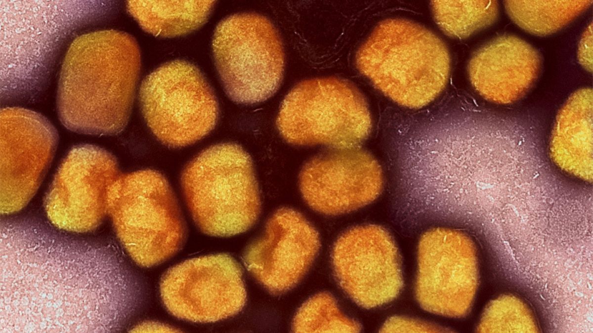 Eine mikroskopische Nahaufnahme des Mpox-Virus. (Foto)