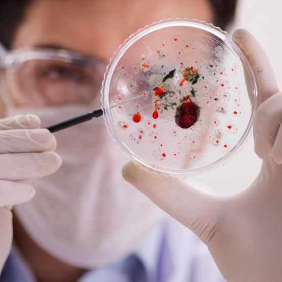 Experten sind besorgt - diese Viren könnten die nächste Pandemie auslösen