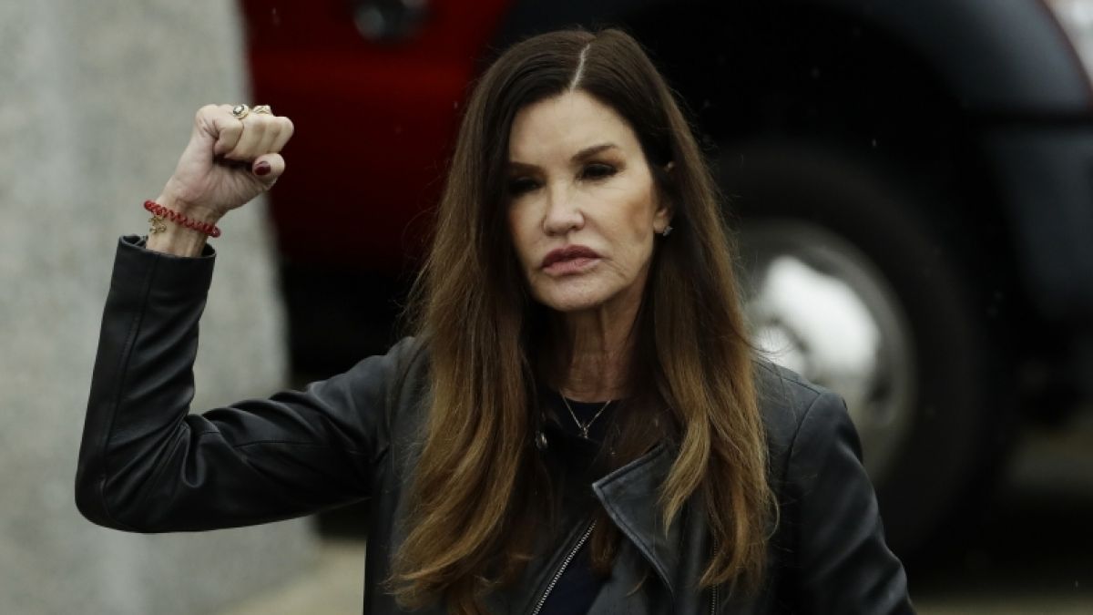 Janice Dickinson hat schwere Verletzungen davongetragen. (Foto)