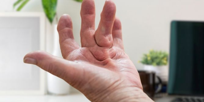 Trifft vor allem Männer