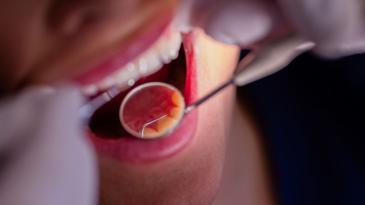 Der CDU-Wirtschaftsrat will kostenlose Zahnarztbesuche aus dem Leistungskatalog der Gesetzlichen Krankenversicherung streichen. (Foto)