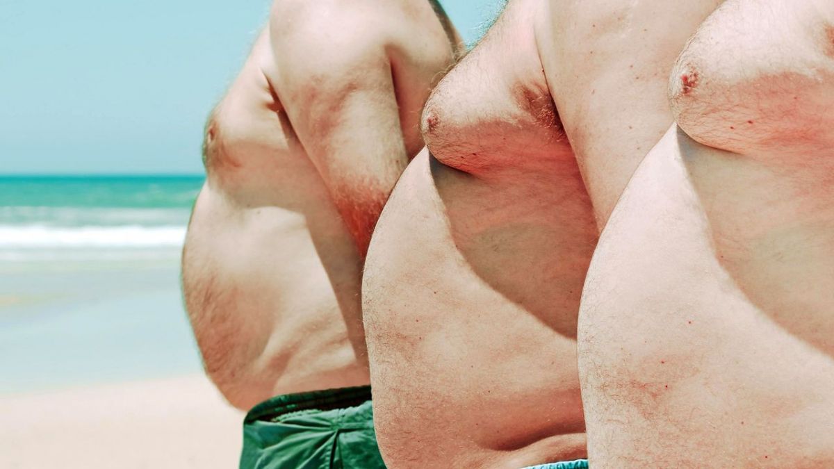 Volkskrankheit Adipositas - Neue Therapien, neue Risiken? bei Arte (Foto)