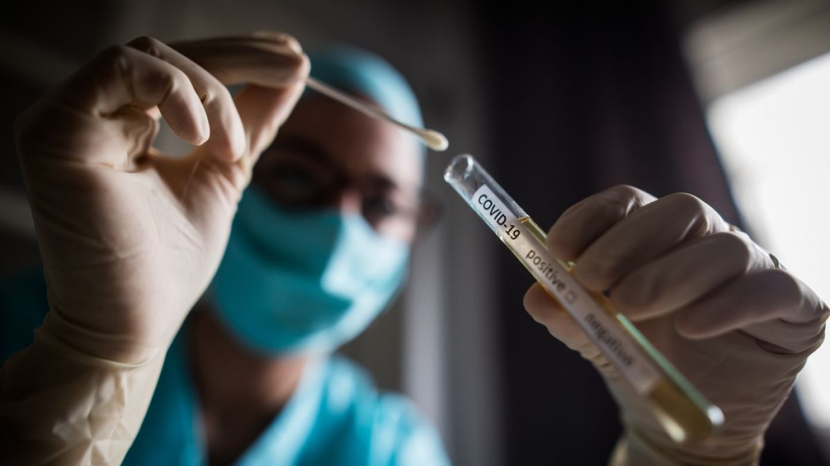 Forscher haben untersucht, wie genau sich Corona-Viren im K&ouml;rper ausbreiten. (Foto)