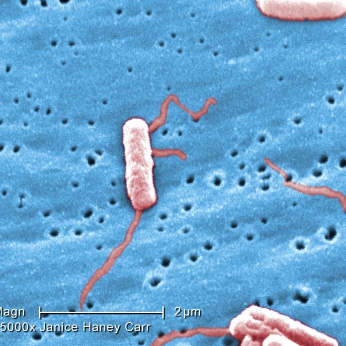 Rätsel um Ausbruch von fataler Legionärskrankheit ungelöst