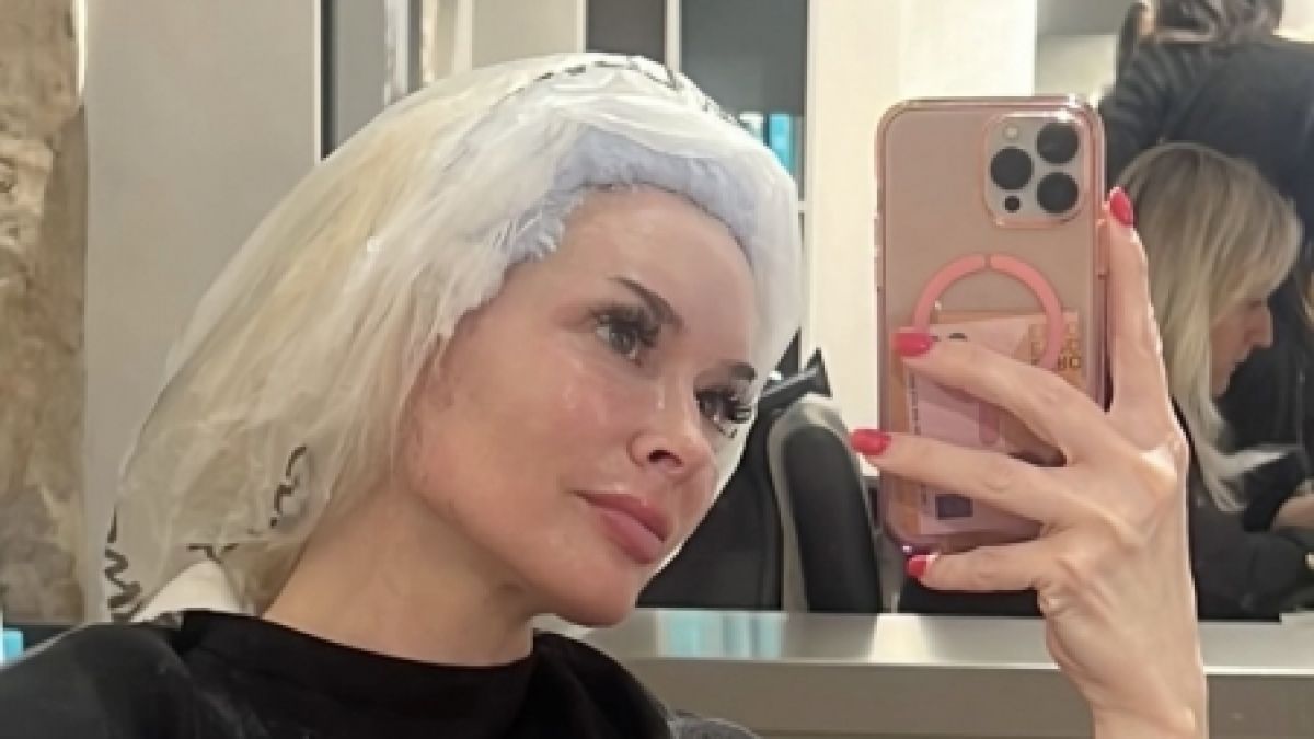 Hier zeigt sich Daniela Katzenberger w&auml;hrend ihres Friseurbesuchs. Die Nachwirkungen ihrer j&uuml;ngsten Laserbehandlung sind noch immer sichtbar. (Foto)