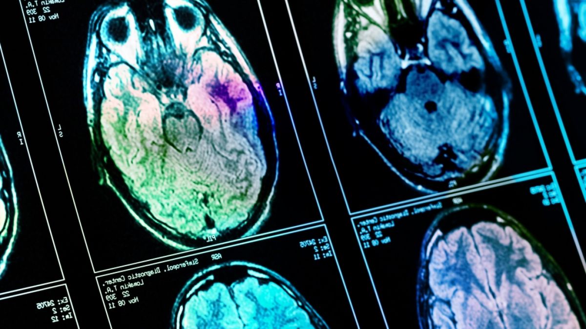 Das menschliche Gehirn muss wie ein Muskel trainiert werden - sonst nimmt seine Leistung ab. (Foto)