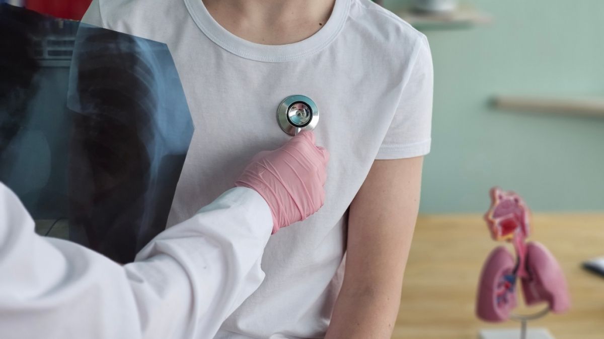 Tuberkulose-Erkrankungen h&auml;ufen sich wieder laut Informationen der WHO. (Foto)