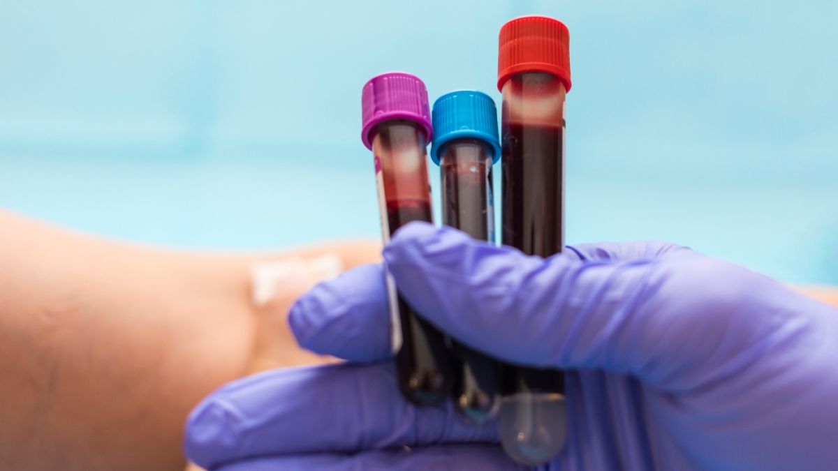 Die verschiedenen Blutgruppen haben unterschiedlich hohe Risiken f&uuml;r bestimmte Erkrankungen. (Foto)