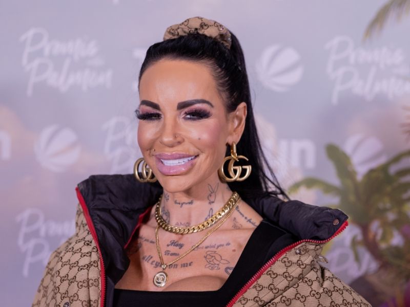 Gina-Lisa Lohfink: Reality-Star gönnt sich beim Beauty-Doc neues Gesicht für 6.000 Euro