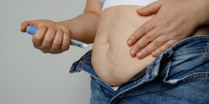 Clever Kosten absetzen