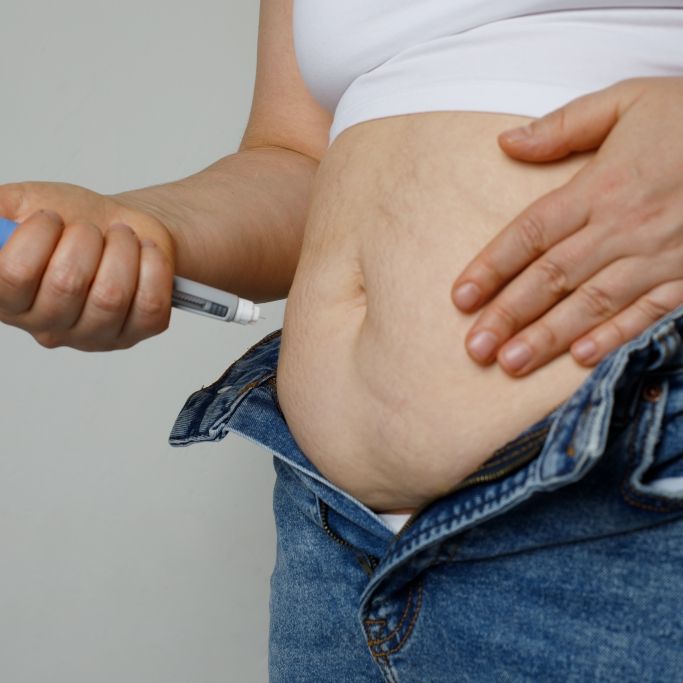 Wie Sie das Finanzamt Ihre Abnehmspritze zahlen lassen