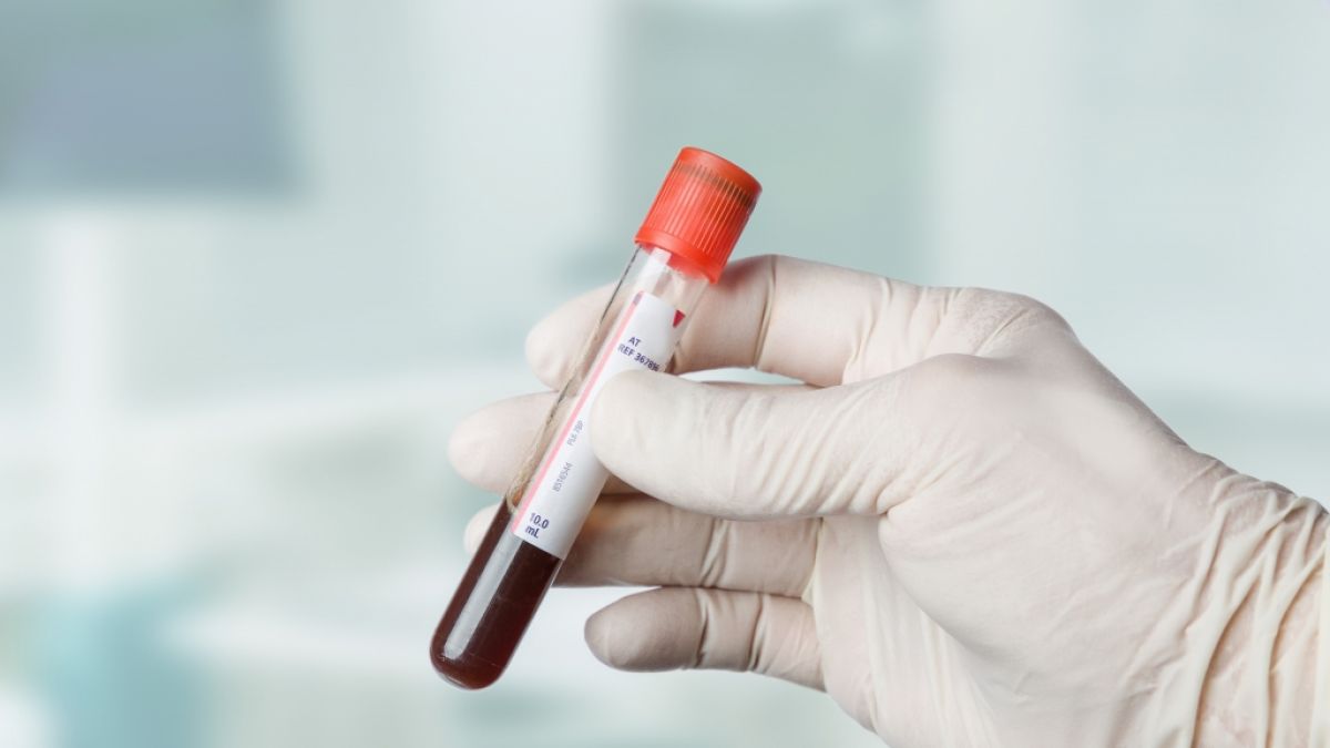 Die Farbe von Blut verr&auml;t einiges &uuml;ber die Gesundheit. (Foto)