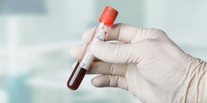 Blut ist nicht einfach nur rot