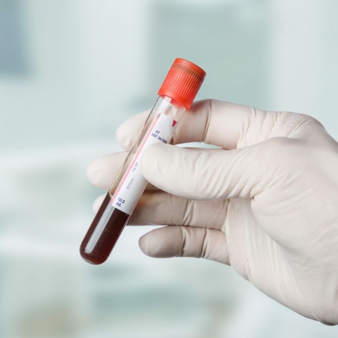 Was die Farbe von Blut über unsere Gesundheit verrät