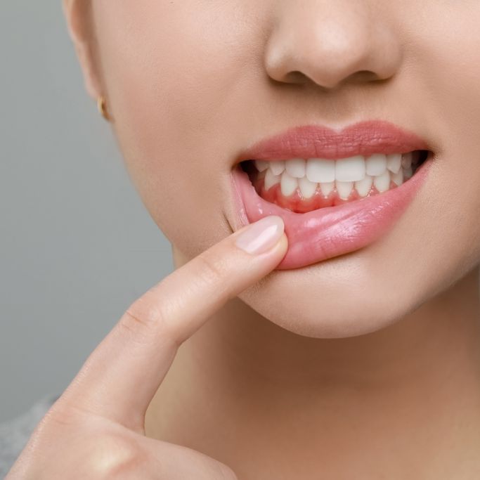 Diese unbekannten Diabetes-Symptome sollten Sie ernst nehmen