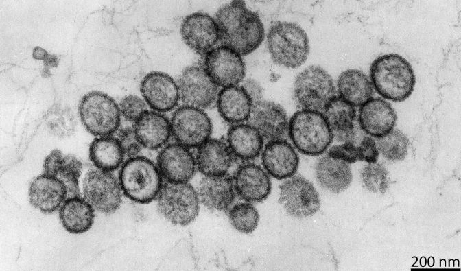Hantavirus auf der "MV Hondius"